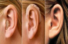 Ear Moulds & Swimmers Ear Plugs by Reems Audiology & Siemens Hearing Care