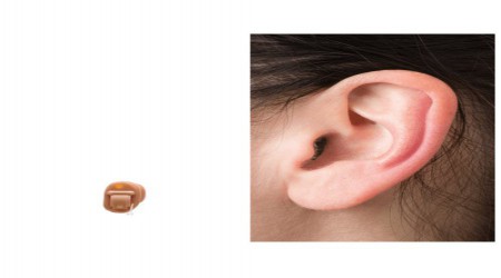 Wireless ITC Hearing Aid by Earcanhear Hearing Aid Centre